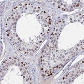 Anti-BRD2 antibody produced in rabbit Prestige Antibodies&#174; Powered by Atlas Antibodies, affinity isolated antibody, buffered aqueous glycerol solution