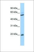 Anti-NR0B1 antibody produced in rabbit affinity isolated antibody