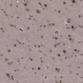 Anti-SF1 antibody produced in rabbit Prestige Antibodies® Powered by Atlas Antibodies, affinity isolated antibody, buffered aqueous glycerol solution