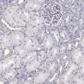 Anti-COX2 antibody produced in rabbit Prestige Antibodies&#174; Powered by Atlas Antibodies, affinity isolated antibody, buffered aqueous glycerol solution