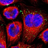 Anti-STK3 antibody produced in rabbit Prestige Antibodies&#174; Powered by Atlas Antibodies, affinity isolated antibody, buffered aqueous glycerol solution
