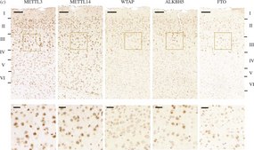 Anti-ALKBH5 antibody produced in rabbit Prestige Antibodies&#174; Powered by Atlas Antibodies, affinity isolated antibody, buffered aqueous glycerol solution