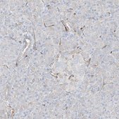 Anti-HLA-E antibody produced in rabbit Prestige Antibodies&#174; Powered by Atlas Antibodies, affinity isolated antibody, buffered aqueous glycerol solution