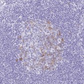 Anti-RRM2 antibody produced in rabbit Prestige Antibodies&#174; Powered by Atlas Antibodies, affinity isolated antibody, buffered aqueous glycerol solution