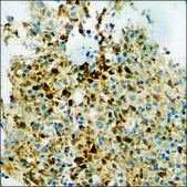 Anti-phospho-Cofilin (pSer3) antibody produced in rabbit affinity isolated antibody