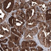 Monoclonal Anti-KLK3 antibody produced in mouse Prestige Antibodies&#174; Powered by Atlas Antibodies, clone CL9422, purified immunoglobulin, buffered aqueous glycerol solution