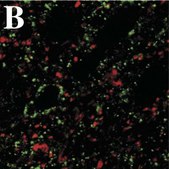 Anti-Polysialic Acid-NCAM Antibody, clone 2-2B ascites fluid, clone 2-2B, Chemicon&#174;