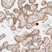 Anti-MYO10 antibody produced in rabbit Prestige Antibodies&#174; Powered by Atlas Antibodies, affinity isolated antibody, buffered aqueous glycerol solution