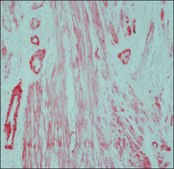 Anti-Mouse IgG (whole molecule)&#8722;Alkaline Phosphatase antibody produced in rabbit affinity isolated antibody, buffered aqueous glycerol solution