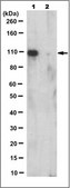 Anti-PML Isoform II Antibody, clone 1A8.1 clone 1A8.1, from mouse