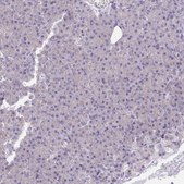 Anti-KCNB1 antibody produced in rabbit Prestige Antibodies&#174; Powered by Atlas Antibodies, affinity isolated antibody, buffered aqueous glycerol solution