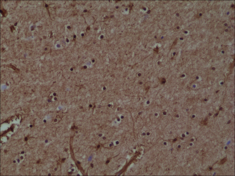 Anti-GST3/GST pi antibody, Rabbit monoclonal recombinant, expressed in HEK 293 cells, clone RM347, purified immunoglobulin