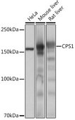 Anti-CPS1 antibody produced in rabbit
