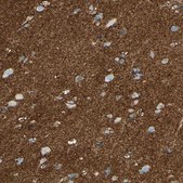 Anti-SLC1A2 antibody produced in rabbit Prestige Antibodies&#174; Powered by Atlas Antibodies, affinity isolated antibody, buffered aqueous glycerol solution