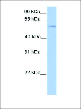 Anti-PLAG1 antibody produced in rabbit affinity isolated antibody