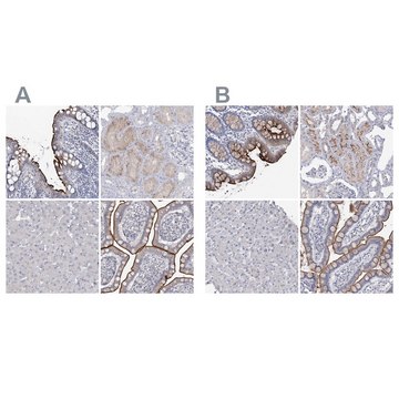 Anti-SLC9A3 antibody produced in rabbit Prestige Antibodies® Powered by Atlas Antibodies, affinity isolated antibody, buffered aqueous glycerol solution