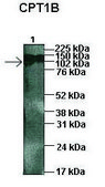 Anti-CPT1B antibody produced in rabbit affinity isolated antibody