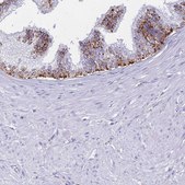 Anti-GAA antibody produced in rabbit Prestige Antibodies&#174; Powered by Atlas Antibodies, affinity isolated antibody, buffered aqueous glycerol solution