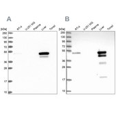 Anti-ABAT antibody produced in rabbit Prestige Antibodies® Powered by Atlas Antibodies, affinity isolated antibody, buffered aqueous glycerol solution