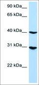 Anti-IRF1 (AB1) antibody produced in rabbit affinity isolated antibody
