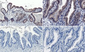 Anti-AMPK &#945;1 Antibody Upstate&#174;, from rabbit
