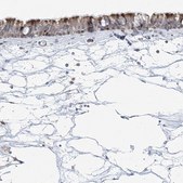 Anti-CEP164 antibody produced in rabbit Prestige Antibodies&#174; Powered by Atlas Antibodies, affinity isolated antibody, buffered aqueous glycerol solution