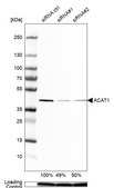 Anti-ACAT1 antibody produced in rabbit Prestige Antibodies&#174; Powered by Atlas Antibodies, affinity isolated antibody, buffered aqueous glycerol solution