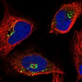 Anti-OSBP antibody produced in rabbit Prestige Antibodies&#174; Powered by Atlas Antibodies, affinity isolated antibody, buffered aqueous glycerol solution