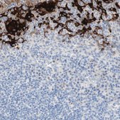 Anti-SPINK5 antibody produced in rabbit Prestige Antibodies&#174; Powered by Atlas Antibodies, affinity isolated antibody, buffered aqueous glycerol solution