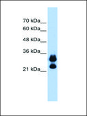 Anti-HIST1H1C antibody produced in rabbit affinity isolated antibody