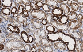 Anti-VDAC1 Antibody, clone 3M22, ZooMAb&#174; Rabbit Monoclonal recombinant, expressed in HEK 293 cells