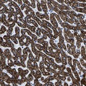 Anti-CPS1 antibody produced in rabbit Prestige Antibodies&#174; Powered by Atlas Antibodies, affinity isolated antibody, buffered aqueous glycerol solution