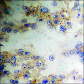 Anti-phospho-TIP60 (pSer86) antibody produced in rabbit affinity isolated antibody