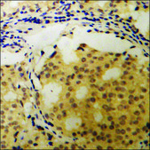 Anti-phospho-Aquaporin 2 (pSer256) antibody produced in rabbit affinity isolated antibody