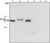 Anti-Monoamine Oxidase B (C-terminal) antibody produced in rabbit affinity isolated antibody, ~1.5 mg/mL, buffered aqueous solution