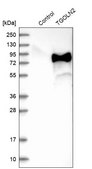 Anti-TGOLN2 antibody produced in rabbit Prestige Antibodies&#174; Powered by Atlas Antibodies, affinity isolated antibody, buffered aqueous glycerol solution