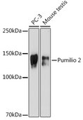 Anti-Pumilio 2 Antibody, clone 7M1B1, Rabbit Monoclonal