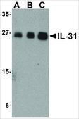 Anti-IL-31 (ab2) antibody produced in rabbit affinity isolated antibody, buffered aqueous solution