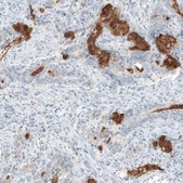 Monoclonal Anti-MUC2 antibody produced in mouse Prestige Antibodies&#174; Powered by Atlas Antibodies, clone CL9148, purified immunoglobulin, buffered aqueous glycerol solution