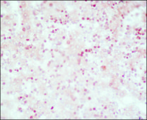 Monoclonal Anti-&#945;-Fetoprotein (AFP) antibody produced in mouse ascites fluid, clone C3