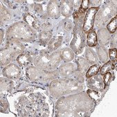 Anti-PDK1 antibody produced in rabbit Prestige Antibodies&#174; Powered by Atlas Antibodies, affinity isolated antibody, buffered aqueous glycerol solution