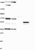 Anti-DPP4 antibody produced in rabbit Prestige Antibodies® Powered by Atlas Antibodies, affinity isolated antibody, buffered aqueous glycerol solution
