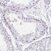 Anti-MORC4 antibody produced in rabbit Prestige Antibodies&#174; Powered by Atlas Antibodies, affinity isolated antibody, buffered aqueous glycerol solution