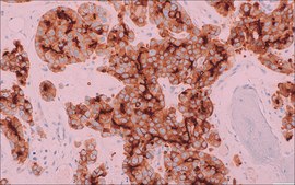 PSMA (EP192) Rabbit Monoclonal Primary Antibody