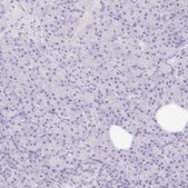 Anti-NR2E1 antibody produced in rabbit Prestige Antibodies® Powered by Atlas Antibodies, affinity isolated antibody, buffered aqueous glycerol solution