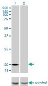 Monoclonal Anti-FTL antibody produced in mouse clone X1, purified immunoglobulin, buffered aqueous solution