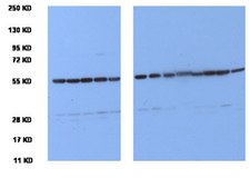 Anti-Tubulin Antibody, clone YL1/2 clone YL1/2, Chemicon&#174;, from rat