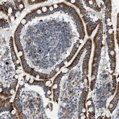 Anti-TPH1 antibody produced in rabbit Prestige Antibodies&#174; Powered by Atlas Antibodies, affinity isolated antibody, buffered aqueous glycerol solution