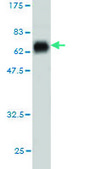 Monoclonal Anti-PITX2 antibody produced in mouse clone 2G6, purified immunoglobulin, buffered aqueous solution
