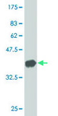 Monoclonal Anti-TG antibody produced in mouse clone 1G3, purified immunoglobulin, buffered aqueous solution